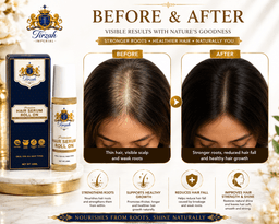 Targeted Scalp Care • Botanical Oils • Convenient Roll-On Application - Image 6